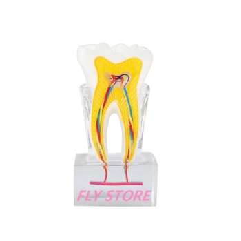 1 Шт. Стоматологическая модель, в шесть раз превосходящая анатомию зубного нерва, обучающая модель Патологической стоматологии, модель анатомии зуба, Odontologia